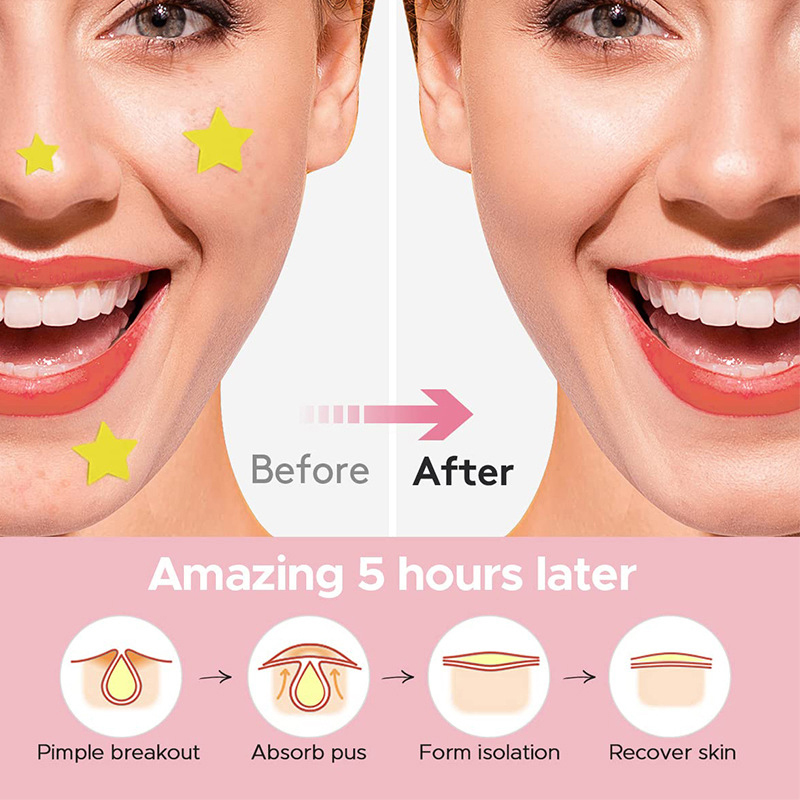 600 قطعة/مجموعة لاصقات نجمية ل - مراجعة Skincare وسعره